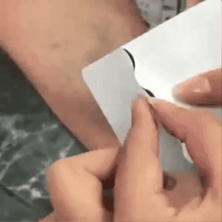 Pack Parches para Varices X4 (48 Parches) ¡Paga en Casa!🏠 🎁¡ENVÍO GRAT –  My Store